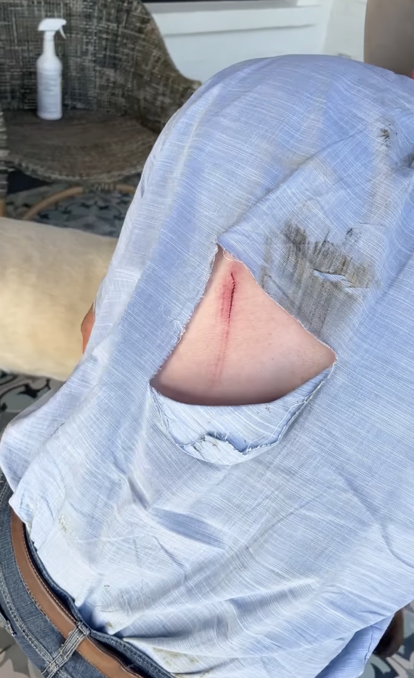 Pioneer Woman Ree Drummond’s husband Ladd suffers brutal injury after he’s ‘run over by a COW’