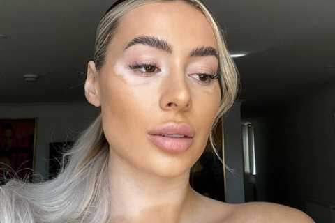 Towie’s Demi Sims strips topless in unfiltered photo as she celebrates her vitiligo