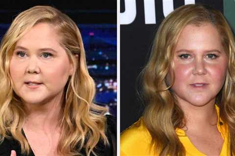 Amid Heaps Of Speculation Around Her Appearance, Amy Schumer Addressed Criticism Of Her Puffier..