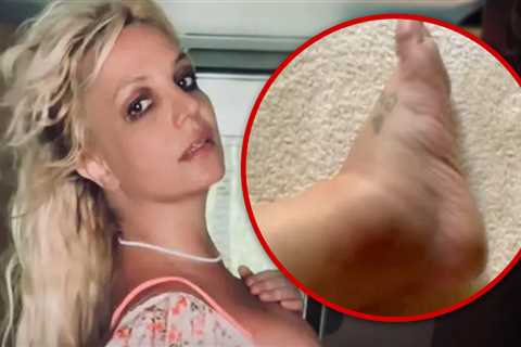 Britney Spears Shows Off Swollen Ankle After Hotel Incident