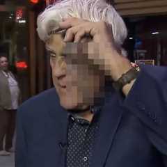 Jay Leno Showed Off His Wild Injuries From Falling Down A 60-Foot Hill, And My God