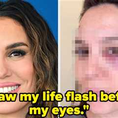 Christy Carlson Romano Was Shot In The Eye While Shooting Clay Pigeons, And She Revealed What..