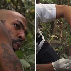 'Naked and Afraid' Contestant Has Stitches Removed From Butt