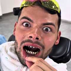 Analysis: Towie Star's Dental Journey Sparks Controversy Amidst Relationship Drama