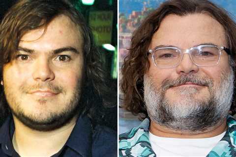 Jack Black -- Good Genes or Good Docs?!