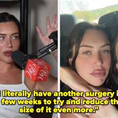Kylie Jenner's BFF Stassie Said She Regrets Her BBL And Apologized For Contributing To Toxic Beauty ..