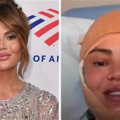 Chrissy Teigen Broke Her Silence After A Photo Of Her Bandaged Face Sparked Concern