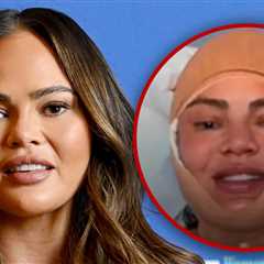 Chrissy Teigen Reveals Facial Surgery During Instagram Live Stream