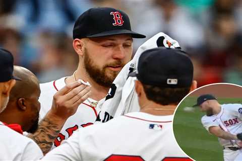 Red Sox’s Garrett Crochet takes comebacker off nose — and stays in the game