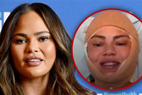 Chrissy Teigen Reveals Facial Surgery During Instagram Live Stream