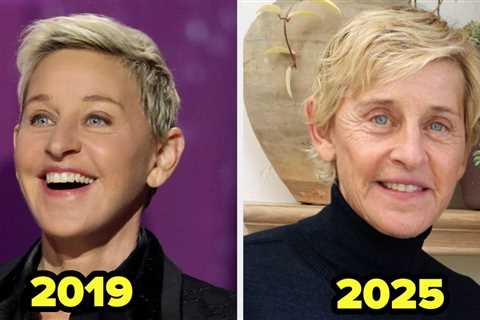 25 Celebs Who Got Rid Of Their Facial Fillers (And Why)