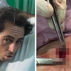 Surfing Star Billy Kemper Gashed By Board, Shows Gnarly Injury