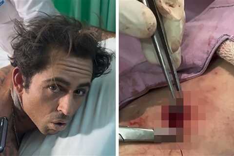 Surfing Star Billy Kemper Gashed By Board, Shows Gnarly Injury