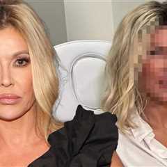 Brandi Glanville Unveils New Face After Getting to Bottom of Disfigurement