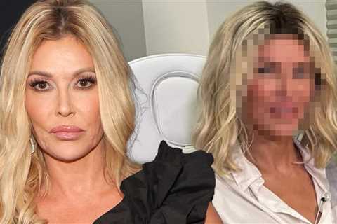 Brandi Glanville Unveils New Face After Getting to Bottom of Disfigurement