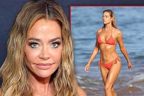 Denise Richards Eager for Next Bikini Season After Doctor Fixes Implants