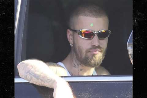 Justin Bieber Sports Star Pimple Patch on Forehead Before 'SWAG II' Release