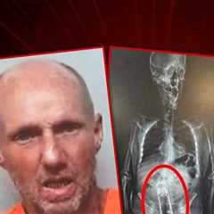 Florida Man Caught With Thermos Up His Rectum, Arrest X-Ray Shows