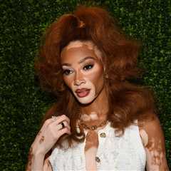 Winnie Harlow Responds To Criticism Of Her Whitney Houston Halloween Costume: ‘My Video Wasn’t..