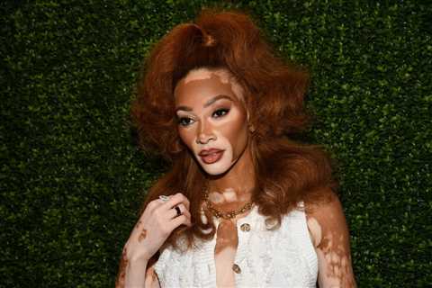 Winnie Harlow Responds To Criticism Of Her Whitney Houston Halloween Costume: ‘My Video Wasn’t..