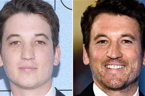 Miles Teller -- Good Genes or Good Docs?!