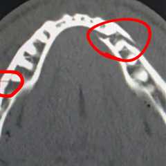 Jake Paul reveals jarring extent of jaw injury after post-fight surgery