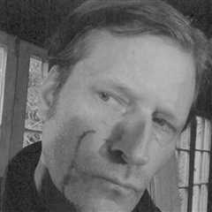 'Back To The Future's Crispin Glover Says Pics Prove Ex Beat Him Bloody