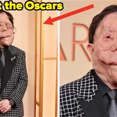 After A Comedian Made Fun Of His Appearance At The Oscars, Adam Pearson Responded Perfectly