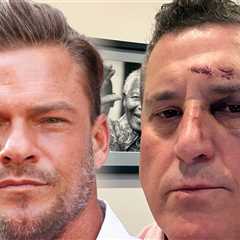 'Reacher' Star Alan Ritchson's Neighbor Received Over 100 Threats After Fight