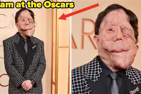 After A Comedian Made Fun Of His Appearance At The Oscars, Adam Pearson Responded Perfectly