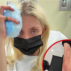 Taylor Momsen Posts Pic, Vid of Gnarly Spider Bite That Put Her in Hospital