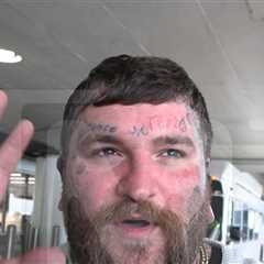 Teddy Swims Says Coachella Sun Badly Burned Him, Going Back for Stagecoach