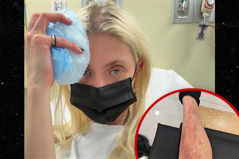 Taylor Momsen Posts Pic, Vid of Gnarly Spider Bite That Put Her in Hospital