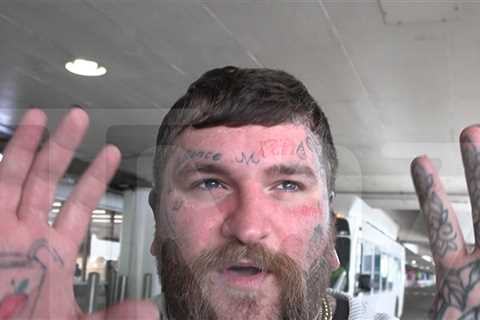 Teddy Swims Says Coachella Sun Badly Burned Him, Going Back for Stagecoach