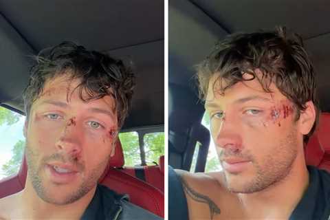 'Traitors' Winner Rob Rausch Banged Up Bad After Bike Slams Into Dog