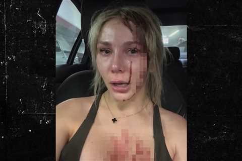 Courtney Stodden Shares Bloody Video After Banging Her Head in Public