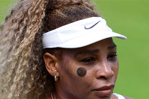 Serena Williams' Comeback Cut Short Due To Doubles Partner's Injury