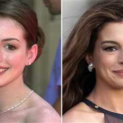 Anne Hathaway Then & Now -- Good Genes or Good Docs, Hot Shots