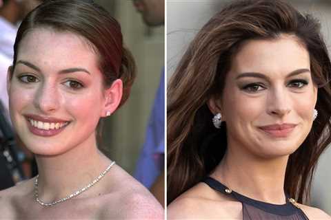 Anne Hathaway Then & Now -- Good Genes or Good Docs, Hot Shots